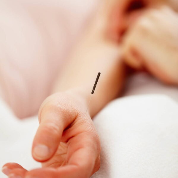 Akupunktur er i dag udbredt på tværs af alder og køn. Det er en behandlingsmetode, der understøtter kroppene dybe ressourcer og evne til at reparere sig selv efter ydre og indre stress, traumer, operationer eller udsættelse for sygdomsfremkaldende belastning.